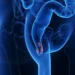 ¡Alerta! Tu zona anal podría estar en riesgo y no lo sabes