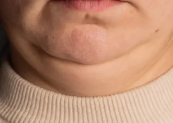 Tu cuello es la clave de tu salud: Lo que no sabías