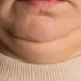 Tu cuello es la clave de tu salud: Lo que no sabías