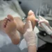 Tus pies te lo dicen: ¿Diabetes o mala circulación