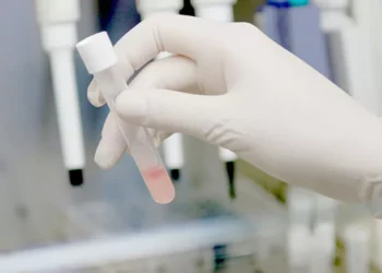 ¡Revolución! Tu saliva podría predecir la evolución del cáncer de cabeza y cuello