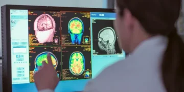 La neurociencia confirma: Eres adolescente hasta los 30
