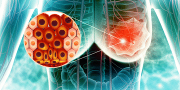 AVANCE CLAVE: Fármaco oncológico contra cáncer de mama arroja resultados muy prometedores