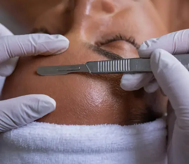 ¡Alerta! Expertos desaconsejan esta moda estética viral