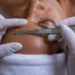 ¡Alerta! Expertos desaconsejan esta moda estética viral