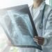 El Secreto del Neumólogo: Claves Imprescindibles para Pulmones Sanos