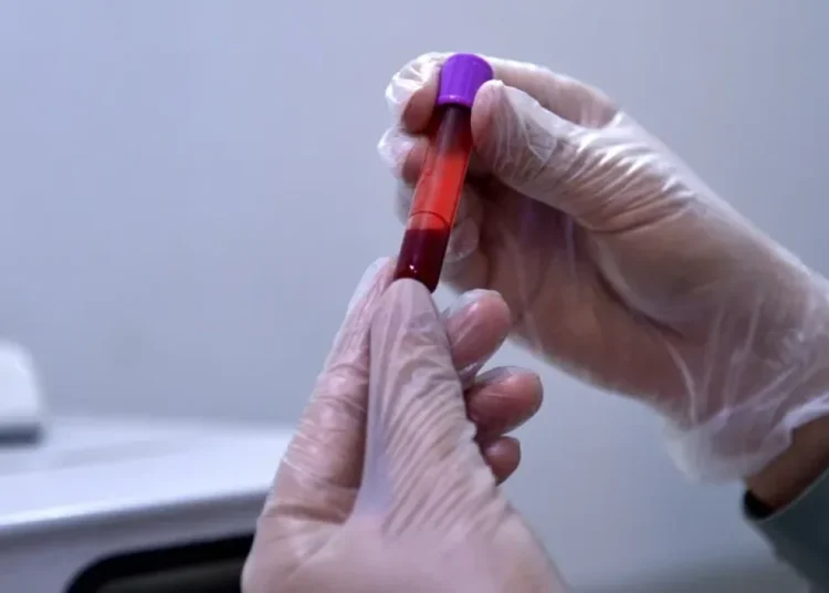 Una muestra de sangre revolucionaria abre la puerta a inmunoterapias personalizadas contra el cáncer