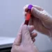 Una muestra de sangre revolucionaria abre la puerta a inmunoterapias personalizadas contra el cáncer