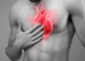 Miocardiopatía hipertrófica: descubre cuándo la cirugía cardíaca es la mejor opción