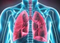 Hipertensión arterial pulmonar en América Latina el peligro del diagnóstico tardío