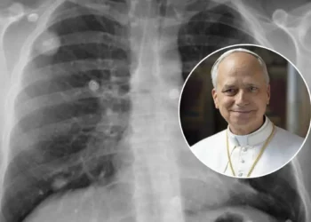 Que es el adenocarcinoma el cancer de pulmon diagnosticado al papa Leon XIV